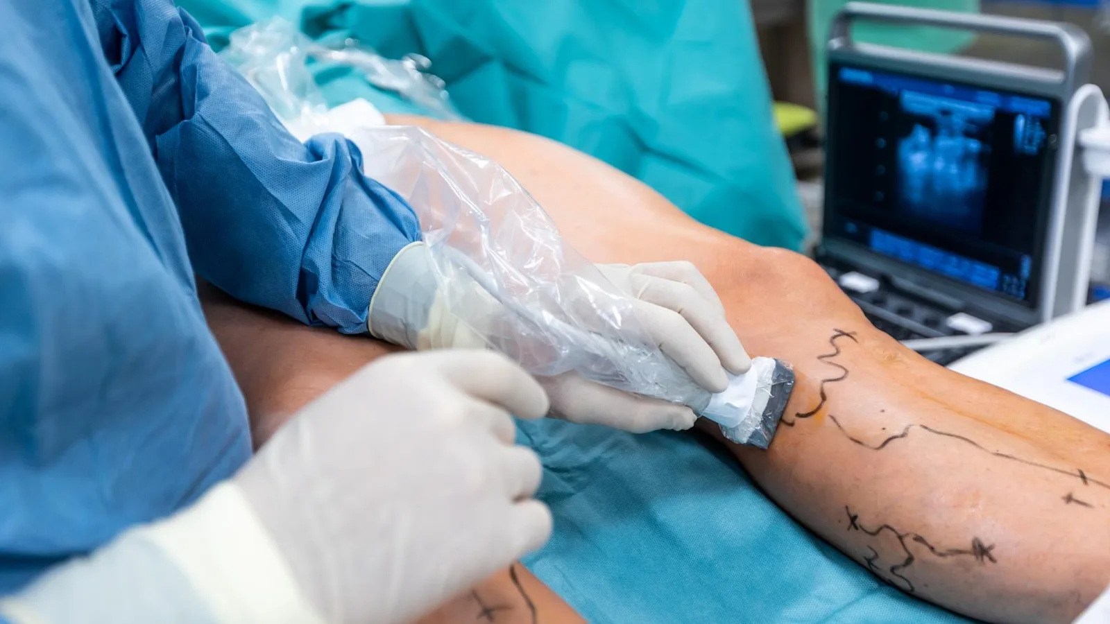 ¿Qué médico trata claudicación intermitente?