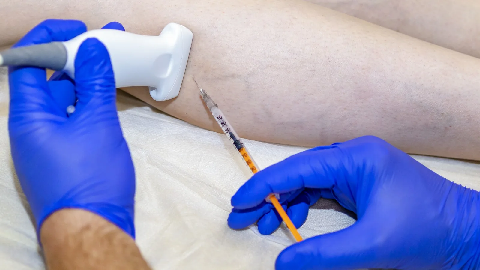 ¿Qué médico trata insuficiencia venosa crónica?