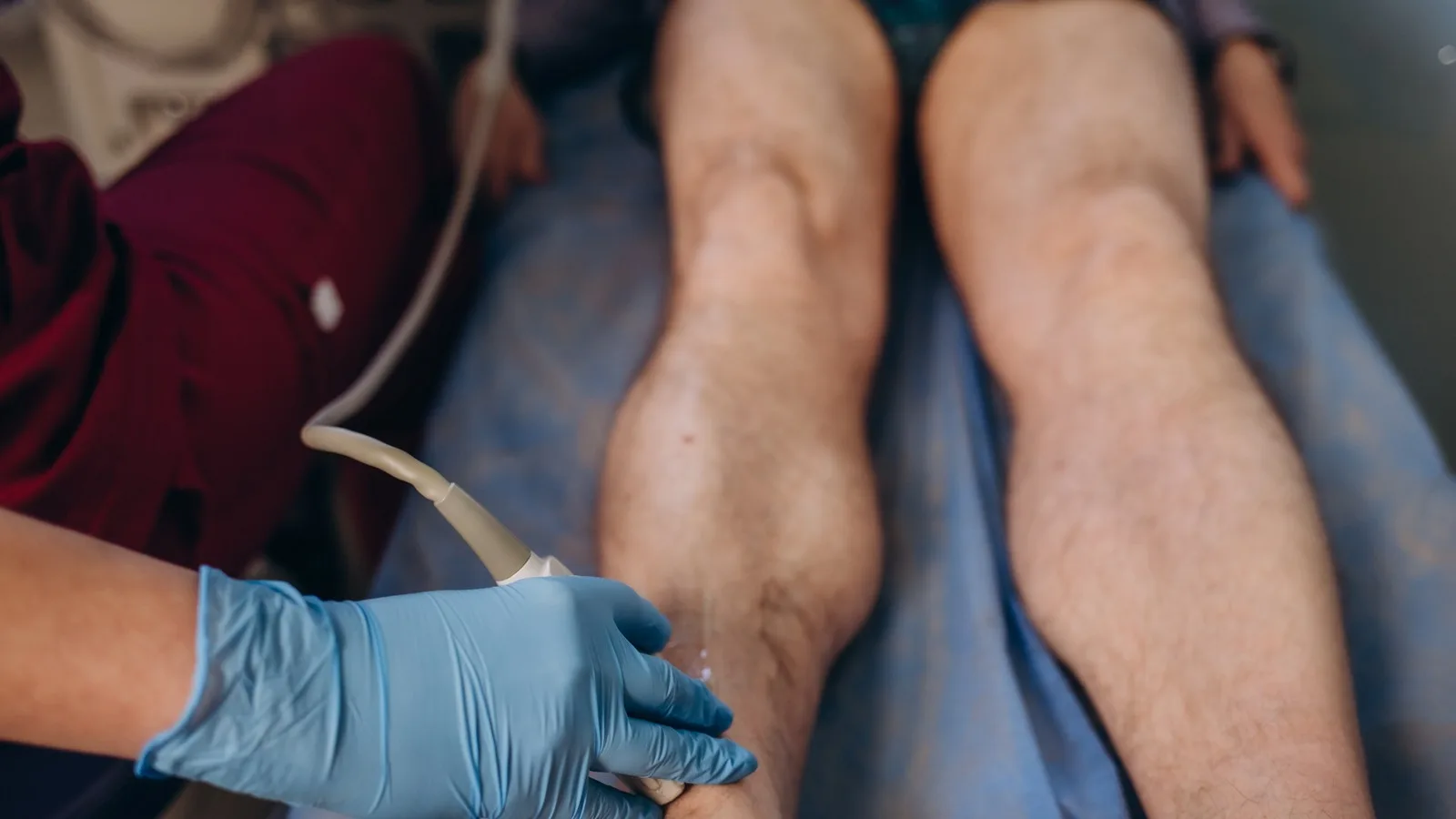 ¿Qué médico trata isquemia de extremidades?